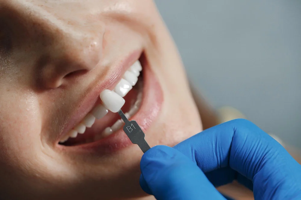 Dental Clinic in Lajpat Nagar